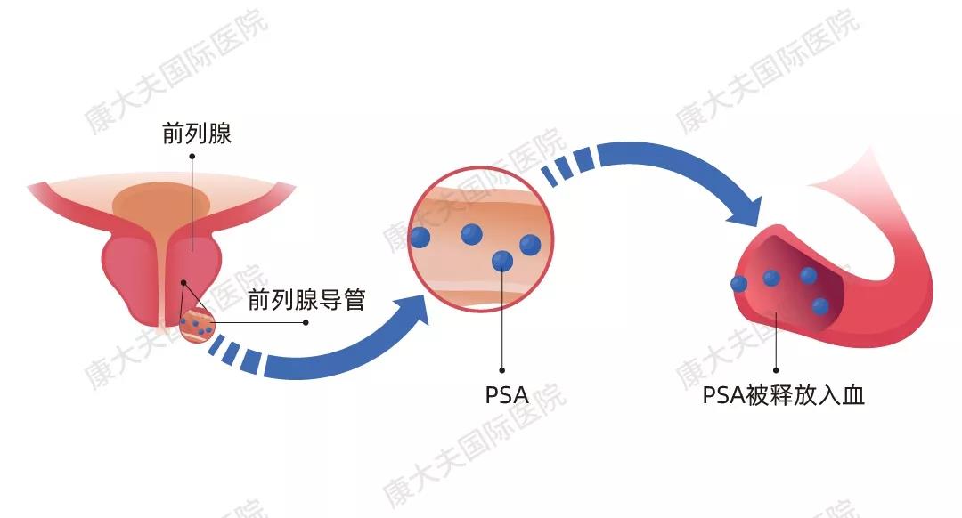 PSA示意图.jpg